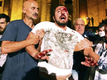 Внаслідок протестів у Грузії постраждали більше півсотні людей