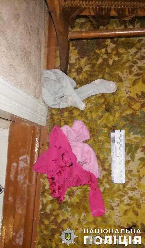 У Миколаєві чоловік облив кислотою дружину і двох дітей: постраждалі –  у лікарні із глибокими опіками