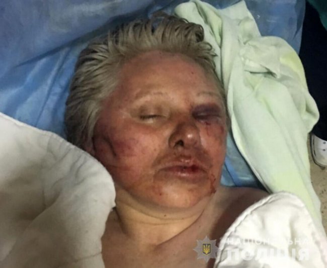 Просять допомогти встановити особу жінки, яку знайшли непритомною на березі Стиру