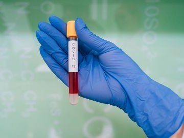 Повідомили статистику щодо COVID-19 в Україні за минулу добу