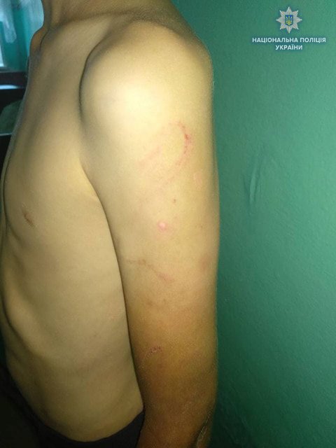Прив'язав ланцюгом до ліжка: вітчим жорстоко знущався над дитиною. ФОТО