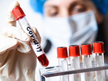 Дві смерті і 60 нових випадків: ситуація з коронавірусом на Волині за останню добу