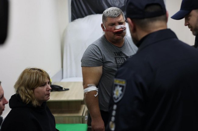 Обстріл цивільної колони в Запоріжжі: кількість загиблих зросла до 30. ФОТО