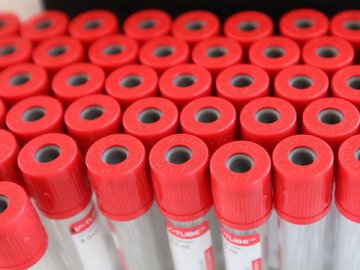 У Чехії почалася друга хвиля пандемії