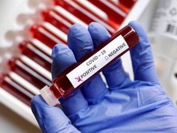 Коронавірус на Волині: де виявили нові випадки станом на 30 червня