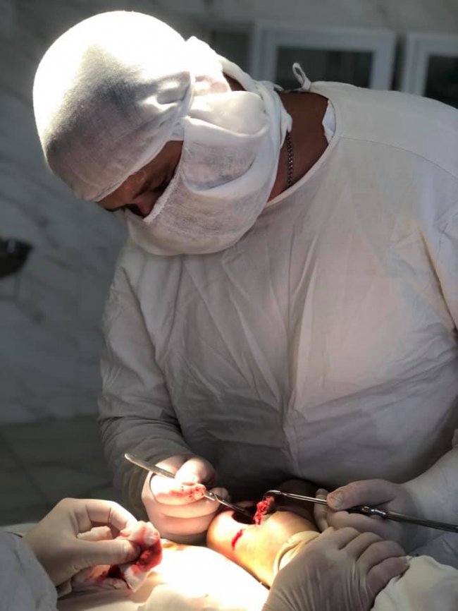 Клеїла шпалери і впала з табуретки: волинські лікарі врятували жінці ногу. ФОТО