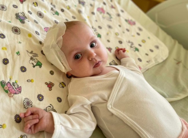 Львівські нейрохірурги прооперували 8-місячну дівчинку з Волині з важкою формою епілепсії