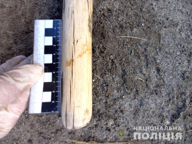 На Рівненщині чоловік з вилами накинувся на поліцейського та проколов йому ногу. ФОТО