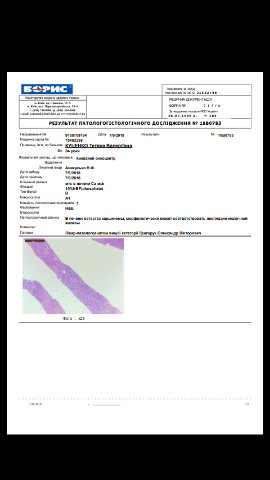 Вижити заради дітей: онкохвора жінка з Волині благає про допомогу