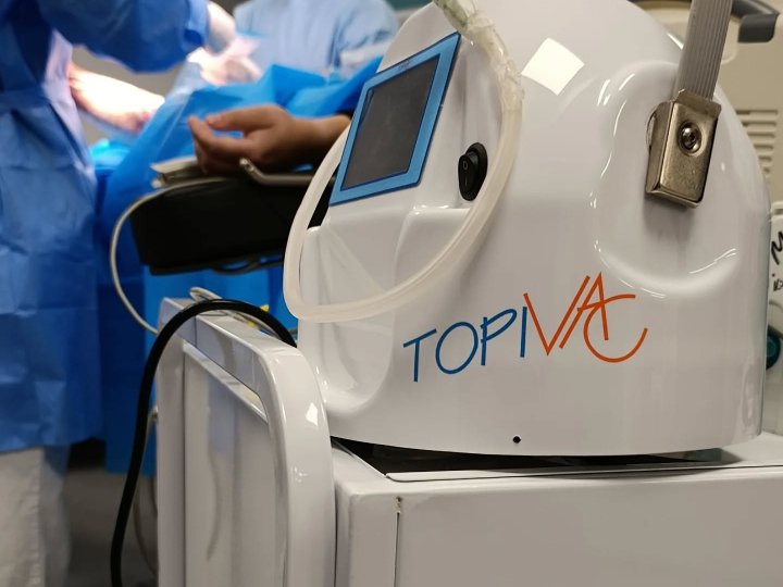 У Володимирському ТМО використовують новітню технологію для загоєння ран