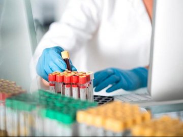 Де на Волині виявили нові випадки коронавірусу станом на 15 липня