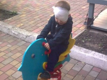 Маленькому волинянину, який травмував око, потрібна допомога
