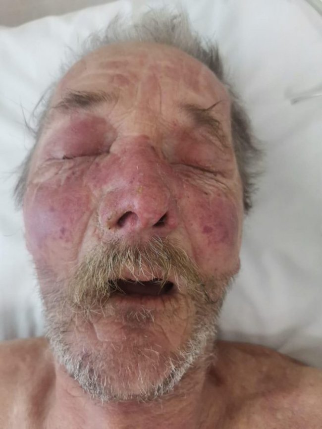 Просять допомогти встановити особу чоловіка, якого доставили у волинську лікарню без свідомості. ФОТО