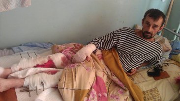 Один з наших поранених - Федя Забедюк...