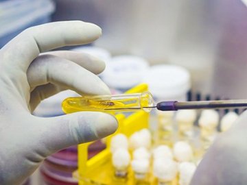  У чоловіка з Луцького району – підозра на правець