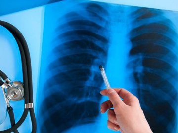 На Волині за січень 72 людини захворіли на туберкульоз