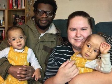  Брат-близнюк врятував недоношене немовля обіймами