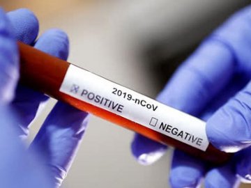 Волинська лікарня закупить тести на коронавірус