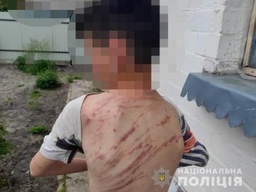 «Виховував» гілкою з дерева: на Волині вітчим побив 13-річного пасинка
