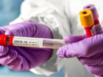 В Україні за добу – 646 нових випадків коронавірусу, з них на Волині – 84