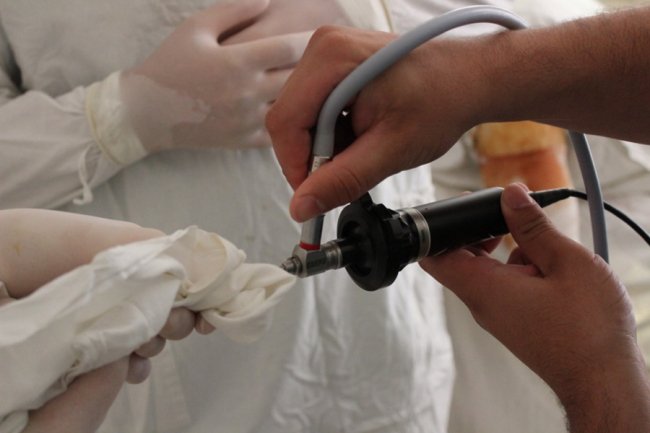 Волинські лікарі провели складну операцію на колінному суглобі. ФОТО