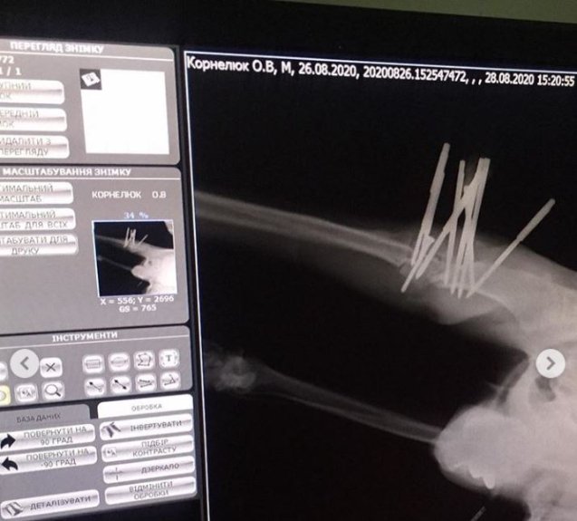 Небайдужі волиняни врятували пса, якого невідомі після наїзду залишили на дорозі. ФОТО