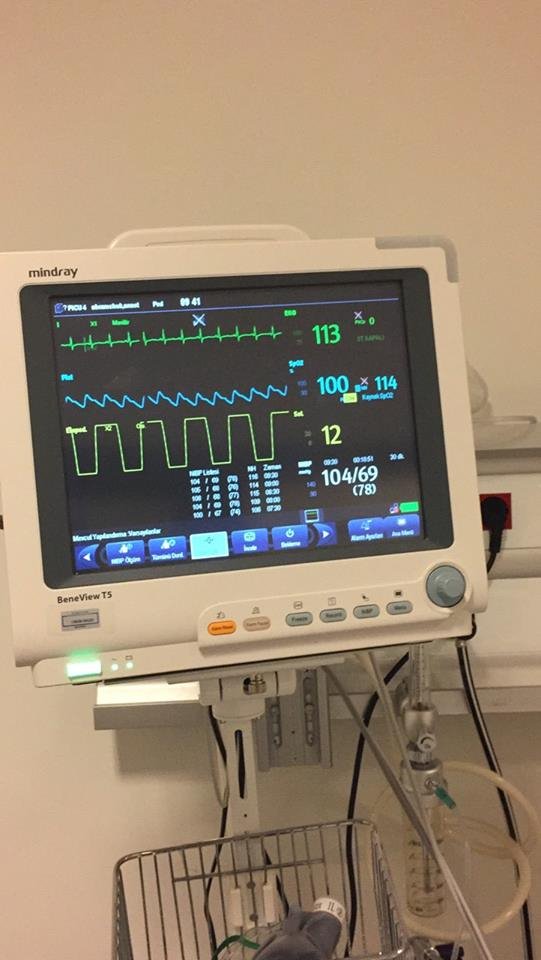 Розповіли, що в онкохворої Настусі Абрамчук зменшилась пухлина