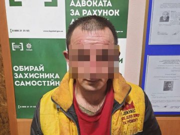 У Миколаєві чоловік облив кислотою дружину і двох дітей: постраждалі –  у лікарні із глибокими опіками