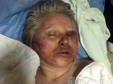 Жінка, яку побили і залишили на березі Стиру, досі – у вкрай важкому стані