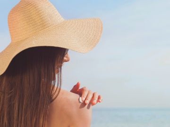 Без сметани та спирту: луцька лікарка розповіла, що робити, якщо ви обгоріли на сонці