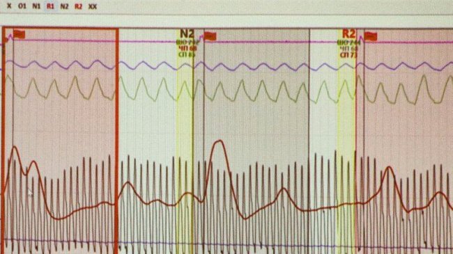 Як працює детектор брехні у Луцьку та чи можна його обдурити. ВІДЕО