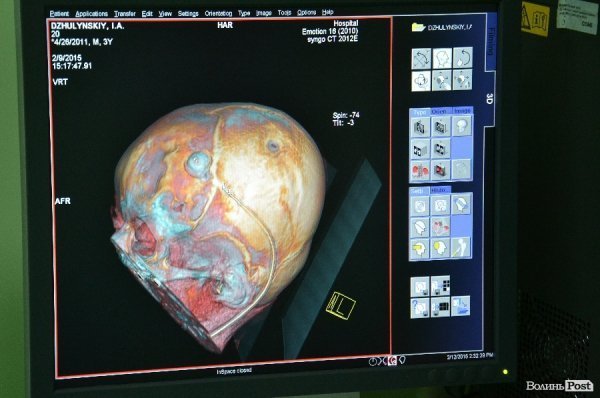 У Луцьку з'явився томограф за 300 тисяч євро. ФОТО