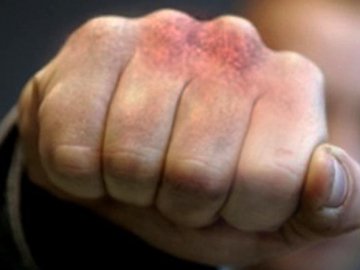 Волинянин побив односельчанина: потерпілий – у лікарні