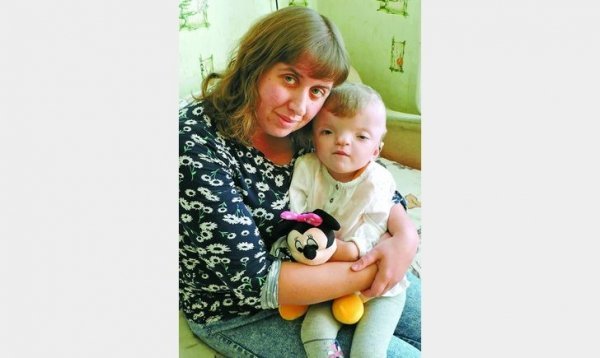 Через рідкісну хворобу маленька волинянка перенесла важку операцію. ФОТО