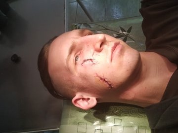 Вночі у Луцьку чоловік ножем поранив «самооборонівця». ФОТО