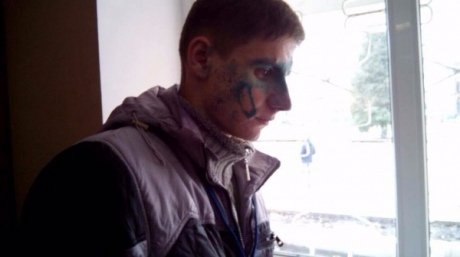 Представників екзит-полів облили зеленкою у Кременчуці