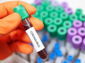 У Збройних силах України – перша смерть від коронавірусу