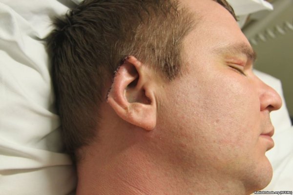 Відрізане вухо, проколи на руках, ‒ катування Булатова. ФОТО