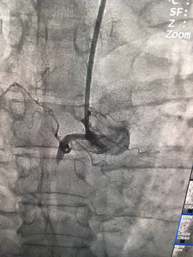 На Волині медики врятували життя чоловіку з інфарктом. ФОТО