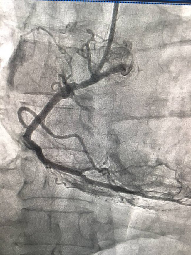 На Волині медики врятували життя чоловіку з інфарктом. ФОТО