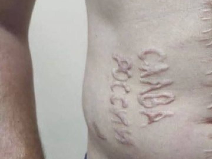 Окупанти випалили на тілі українського полоненого надпис «Слава росії», - розвідка