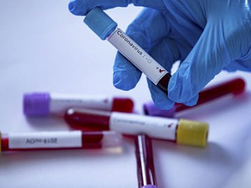 Без летальних випадків: ситуація з коронавірусом на Волині за минулу добу 