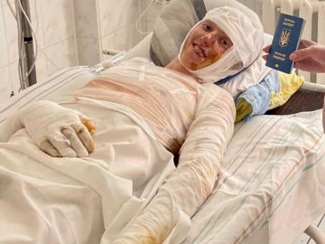 Хлопець, який обгорів у страшній ДТП на Рівненщині, поїхав на лікування в Італію