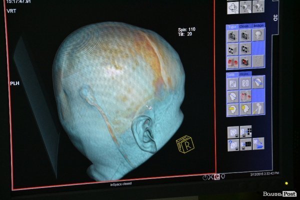 У Луцьку з'явився томограф за 300 тисяч євро. ФОТО