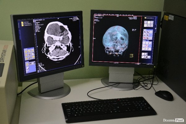 У Луцьку з'явився томограф за 300 тисяч євро. ФОТО