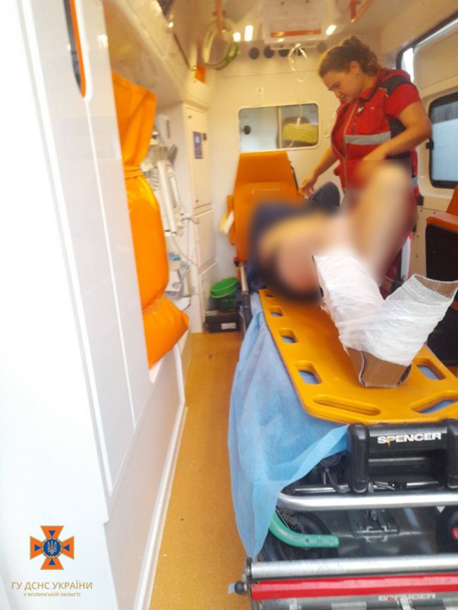 На Волині рятувальники допомогли чоловіку, який упав у підвал та зламав ногу