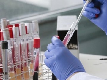 У яких селах Ратнівського району  найбільше хворіють  на COVID-19