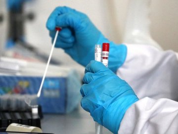 Коронавірус відступає: за минулу добу на Волині виявили 4 випадки інфікування