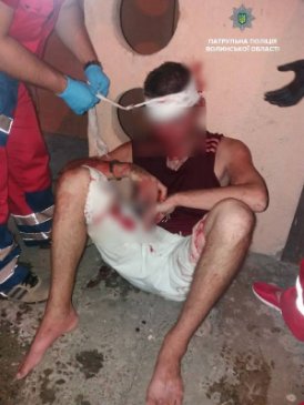 Кривава бійка: у Луцьку чоловіка побили до втрати свідомості