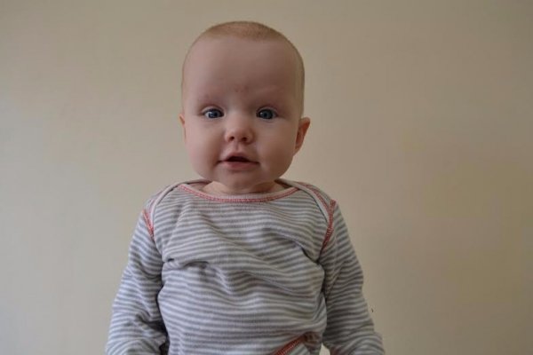 Семимісячна волинянка з багатодітної родини потребує допомоги. ФОТО